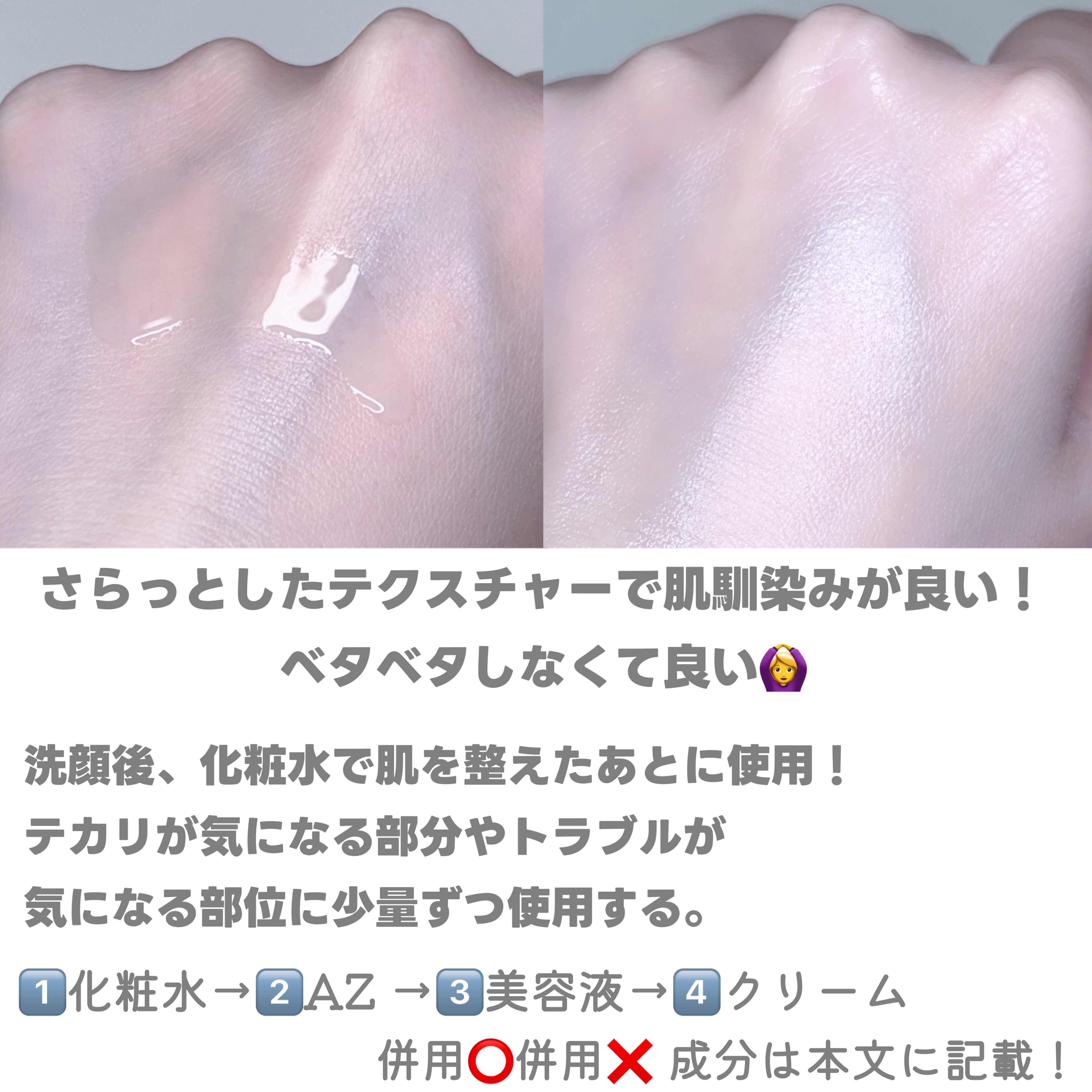 AZアゼライン酸15セラム/コスデバハ/美容液を使ったクチコミ（3枚目）