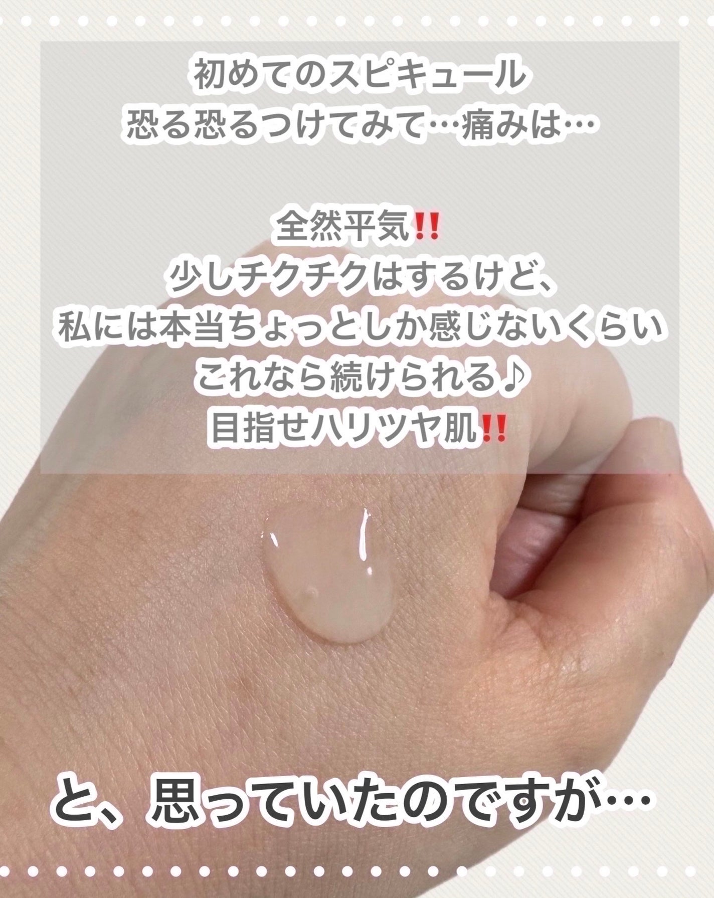 NDSポイントショット2000アンプル/ISOI/美容液を使ったクチコミ(3枚目)