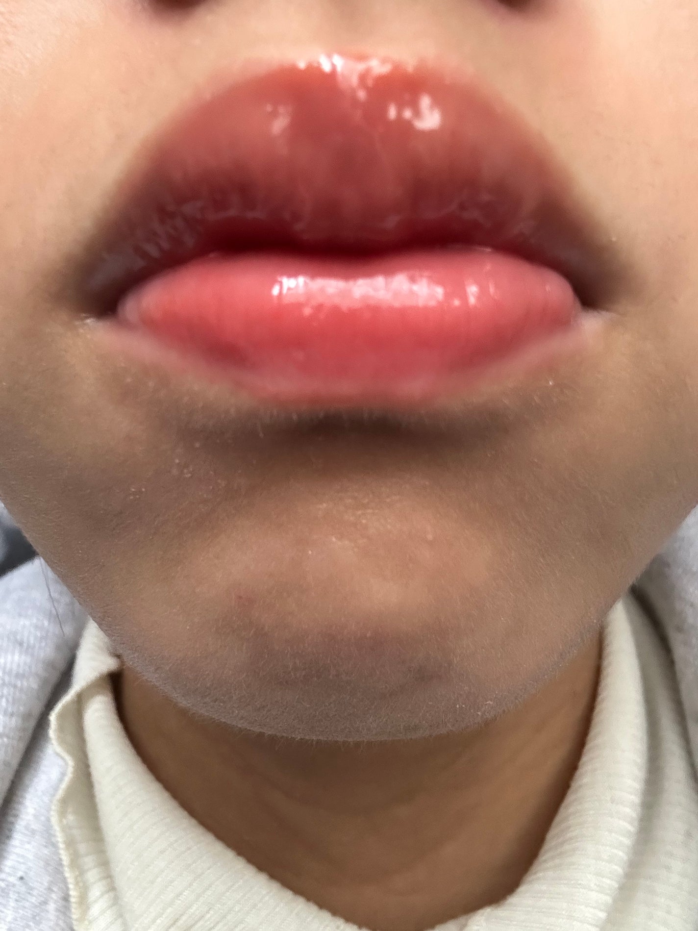 オーバーグロウティント/ETUDE/リップティントを使ったクチコミ(1枚目)