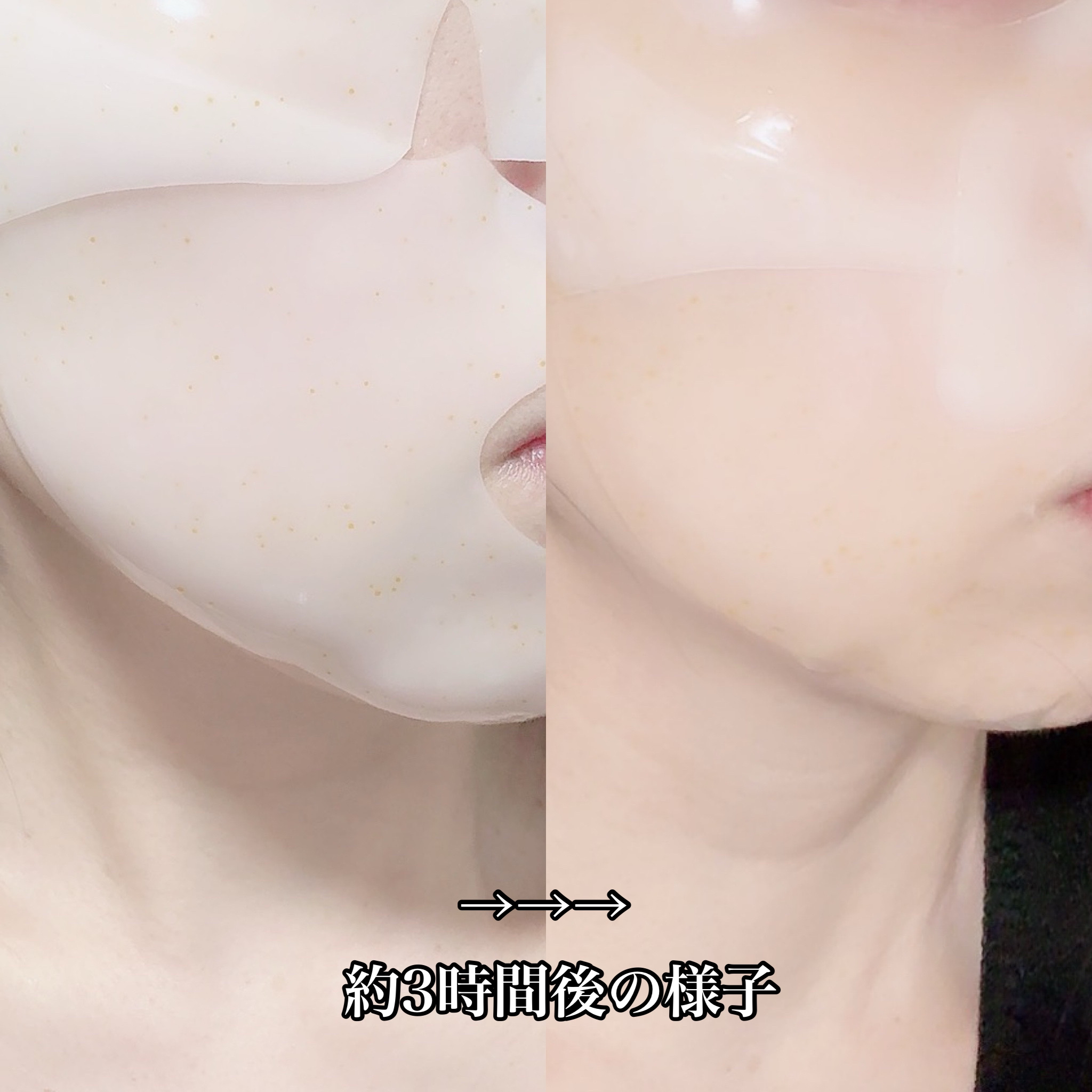 ビタチノールセラム メガショット ゲルマスク/primera/シートマスク・パックを使ったクチコミ（3枚目）