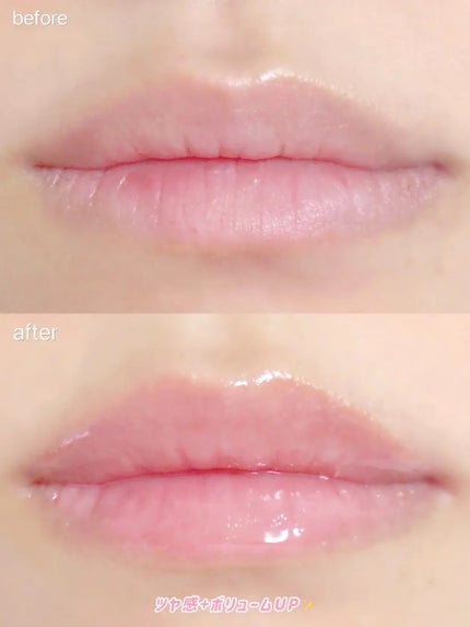 ボリュームリッププランパー/BANILA CO/リッププランパーを使ったクチコミ(3枚目)