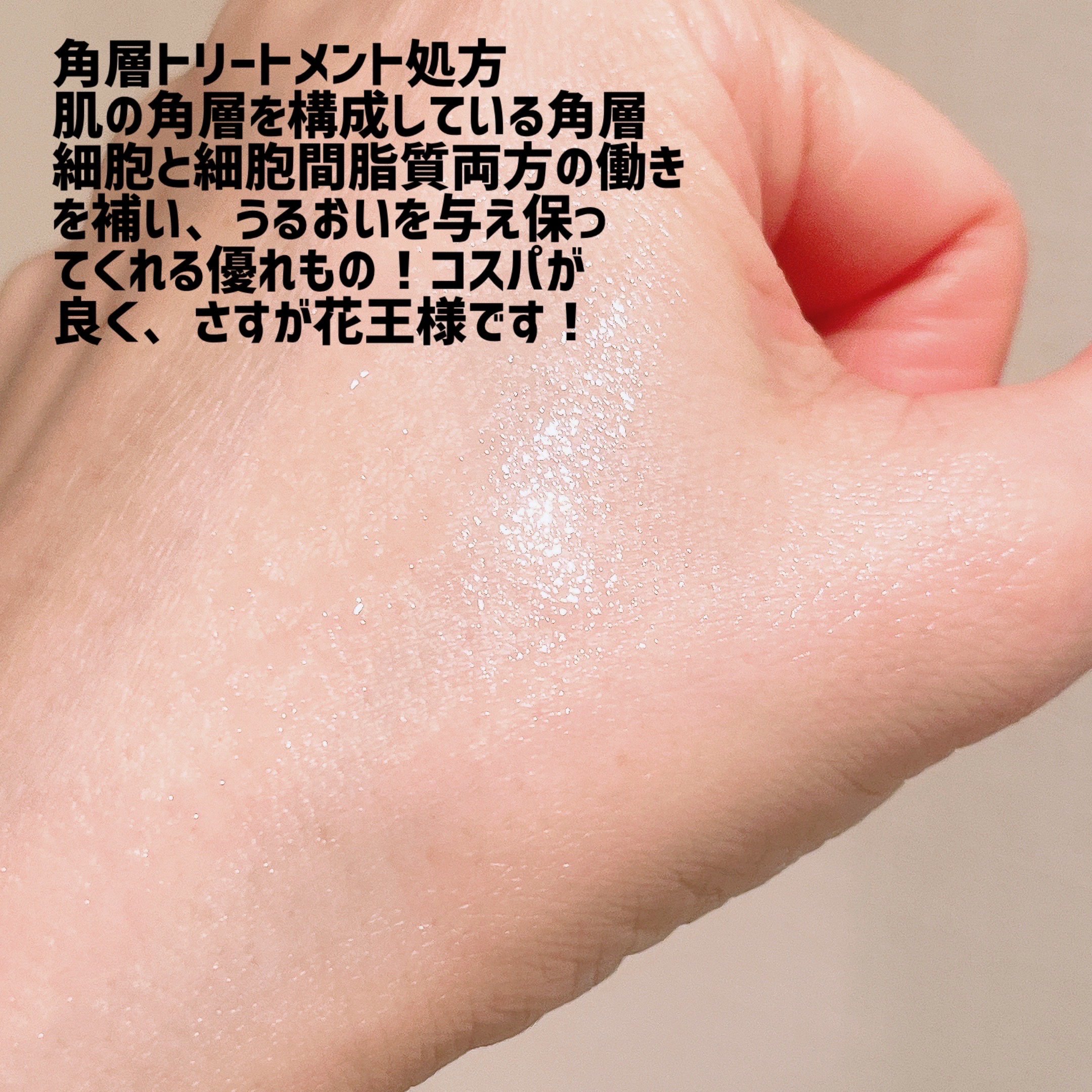 ソフィーナ iP 角層トリートメント 基礎化粧液/SOFINA iP/化粧水を使ったクチコミ（3枚目）