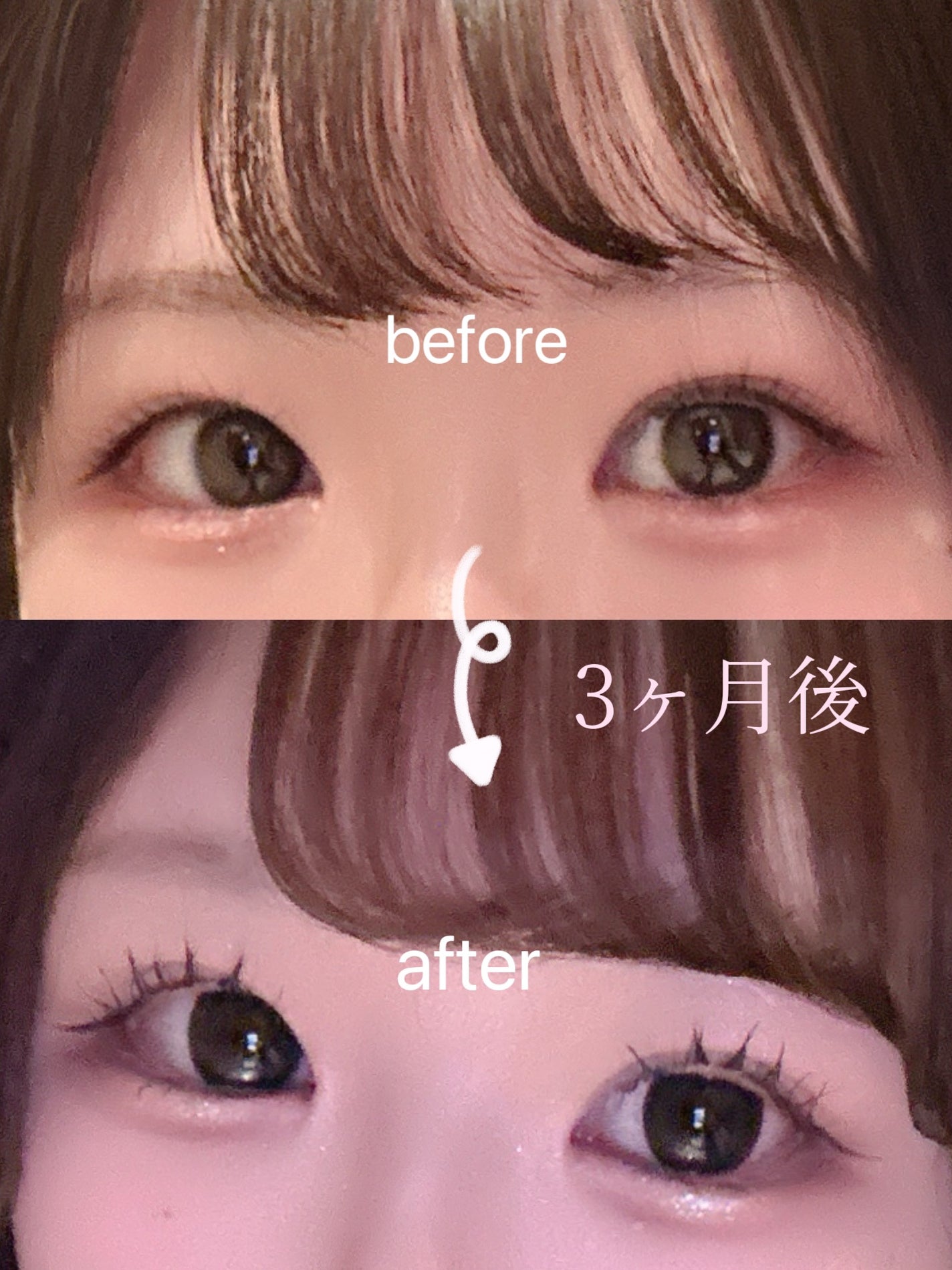 アデノバイタル アイラッシュセラム/資生堂プロフェッショナル/まつげ美容液を使ったクチコミ(1枚目)