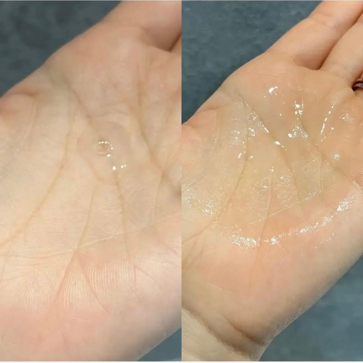 トランスダーマ C/トランスダーマ/美容液を使ったクチコミ(3枚目)