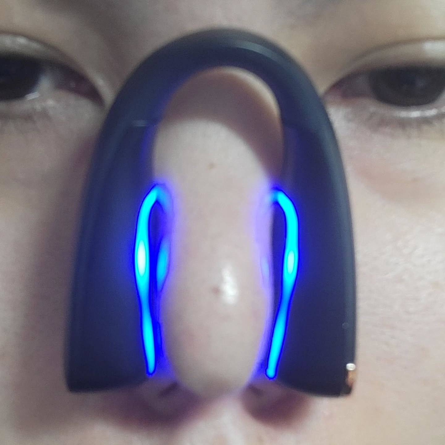 Qnose/NIPLUX/美顔器・マッサージを使ったクチコミ（2枚目）