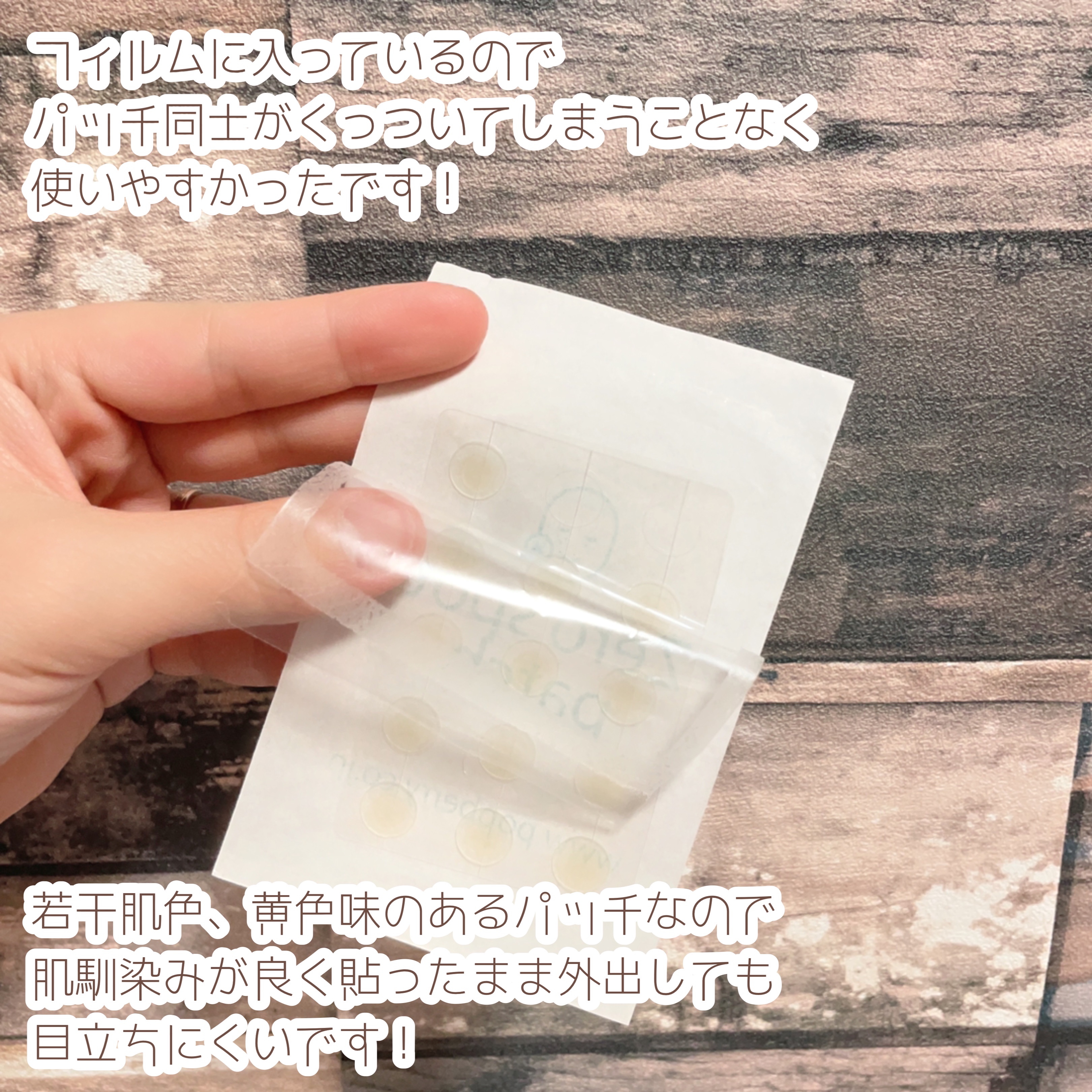 ゼロスポットパッチ/Today’s Cosme/にきびパッチを使ったクチコミ（2枚目）