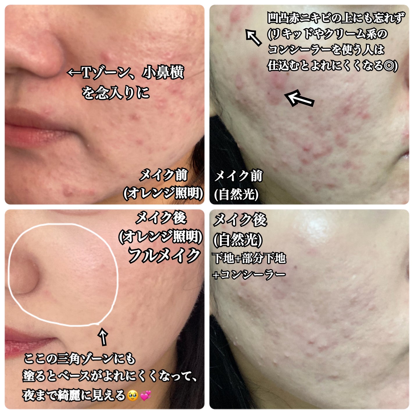 ãã³ãã€ã³ãã»ãã ãªã ã¹ãã£ãã¯/ããªããŽã£ã¹ã¿/åç²§äžå°ã䜿ã£ãã¯ãã³ãïŒ4æç®ïŒ