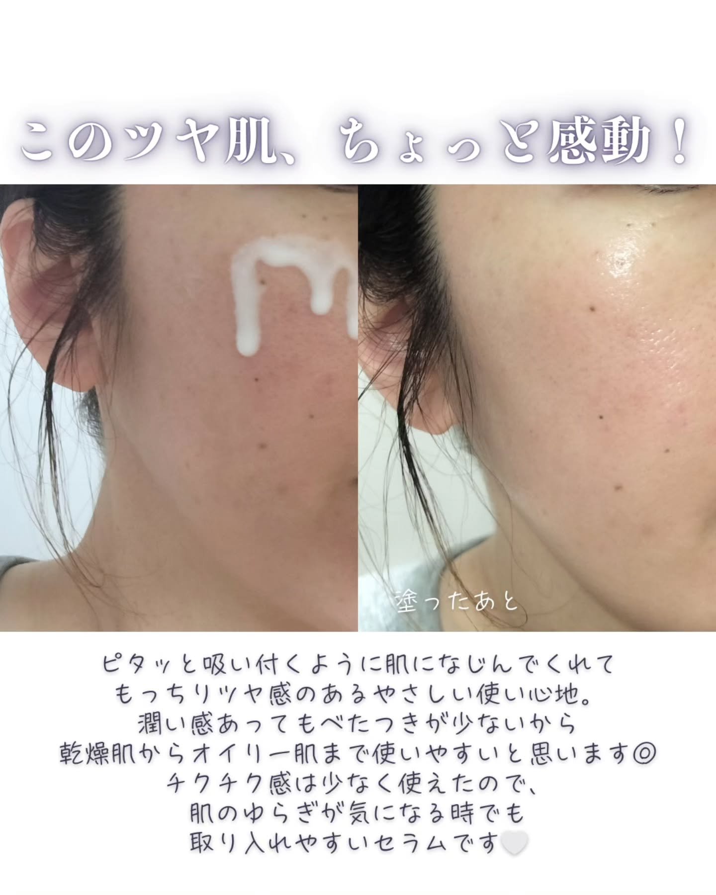 リードルS PDRN+ セラム/VT/美容液を使ったクチコミ（1枚目）