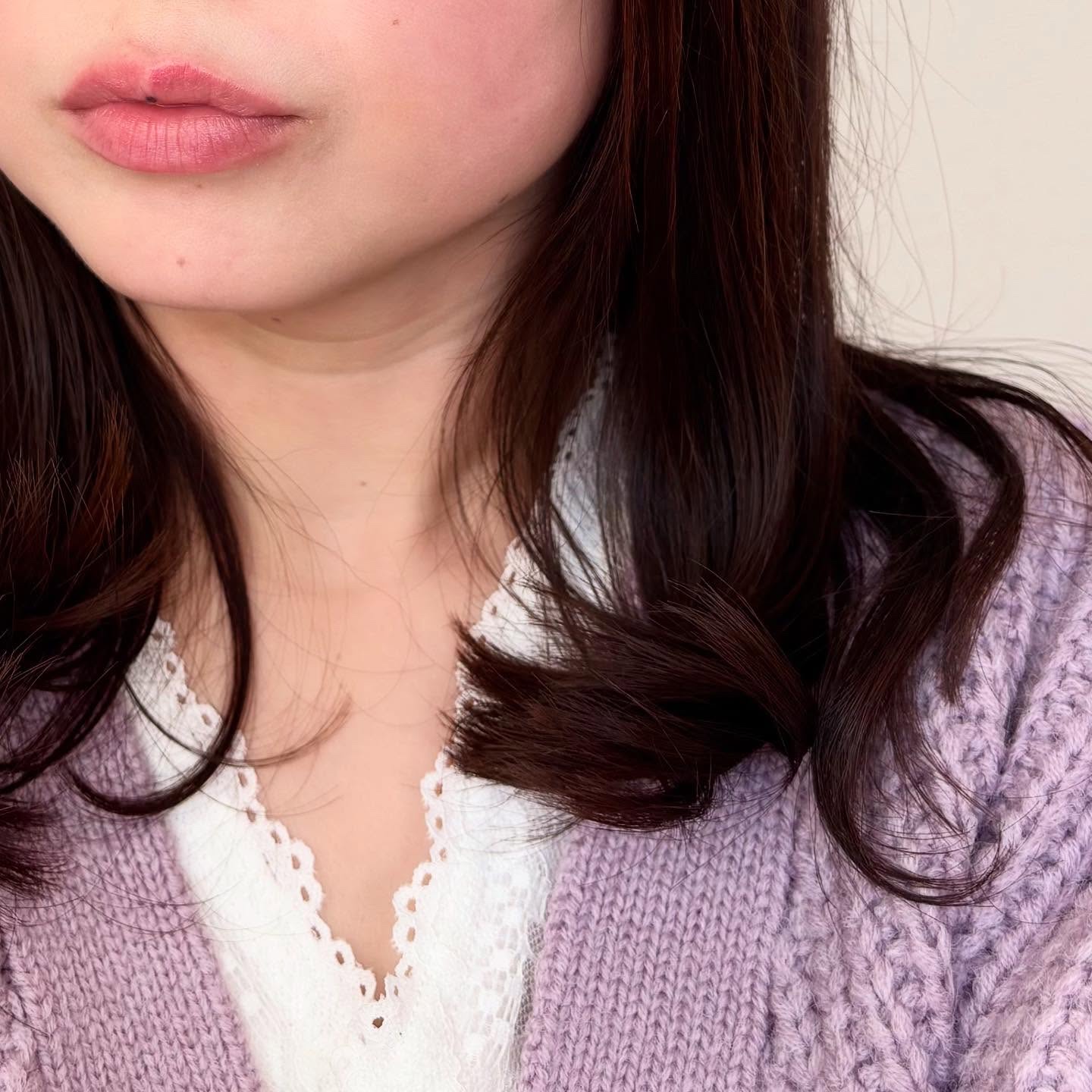 フラルネ リップバー/ALBION/リップ美容液を使ったクチコミ（3枚目）