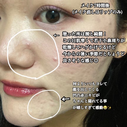 ãã³ãã€ã³ãã»ãã ãªã ã¹ãã£ãã¯/ããªããŽã£ã¹ã¿/åç²§äžå°ã䜿ã£ãã¯ãã³ãïŒ5æç®ïŒ