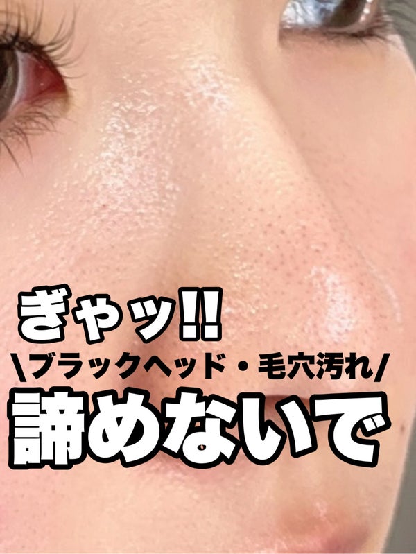 スキンクリア クレンズ オイル <アロマタイプ>/アテニア/オイルクレンジング by イエベの美肌マニアnaomi