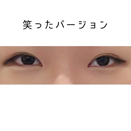 KM ライトタッチコンシーラー/DAISO/リキッドコンシーラーを使ったクチコミ（3枚目）