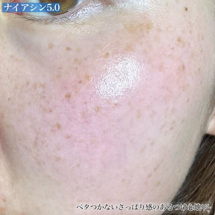 ヒアルサン アクアタイド4.0アンプル/ISCHIA/美容液を使ったクチコミ(4枚目)