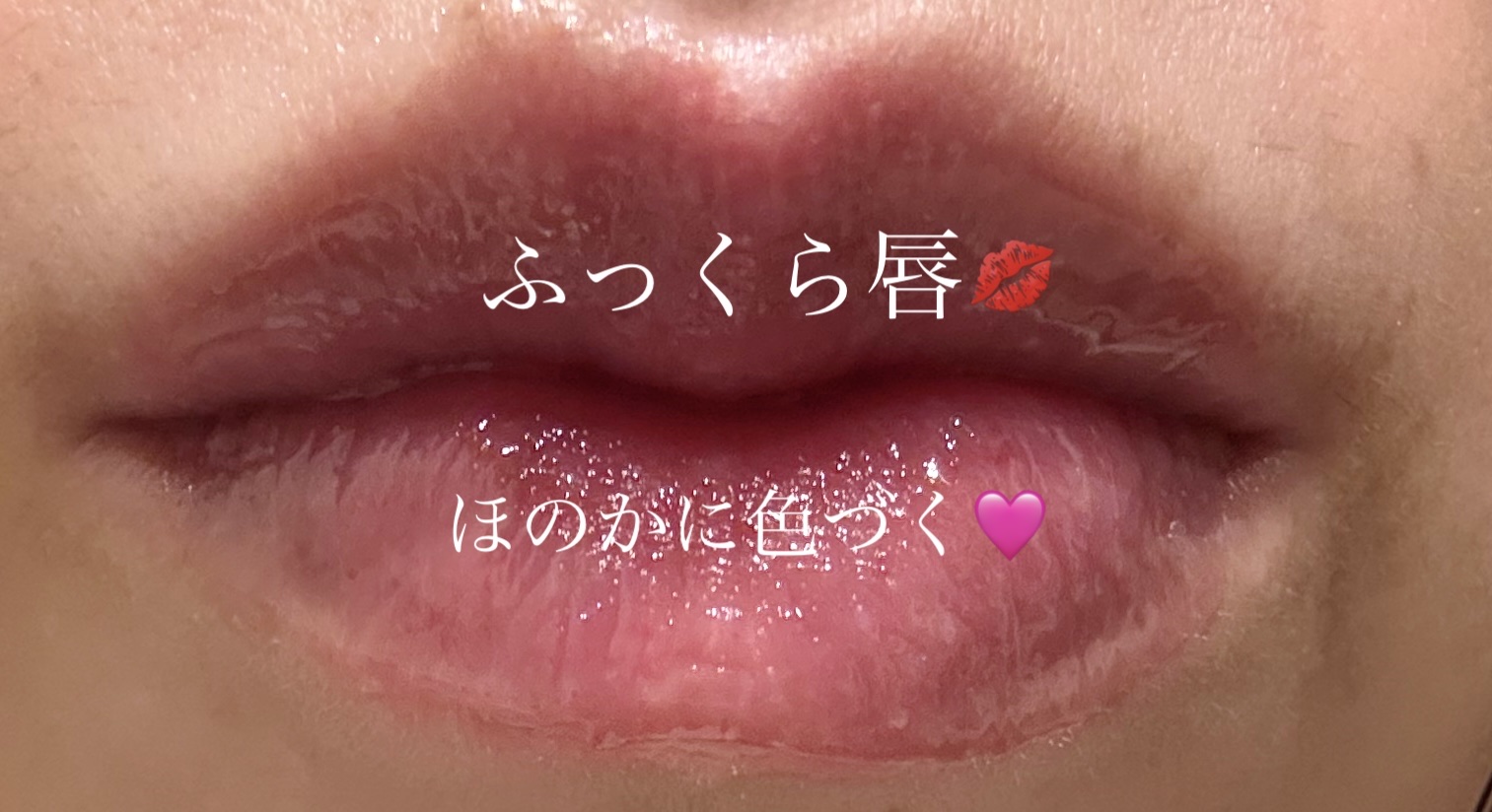 リードルS リッププランパービギナー/VT/リッププランパーを使ったクチコミ（3枚目）