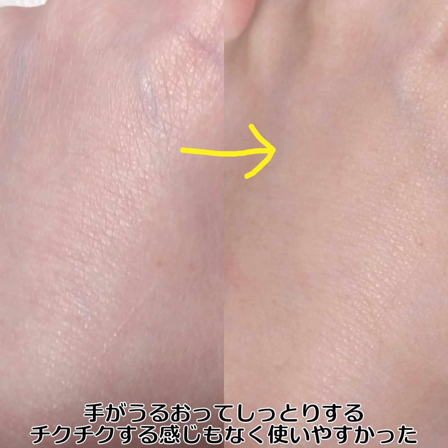 リードルショット リッチハンドマスク/VT/ハンドクリームを使ったクチコミ(7枚目)