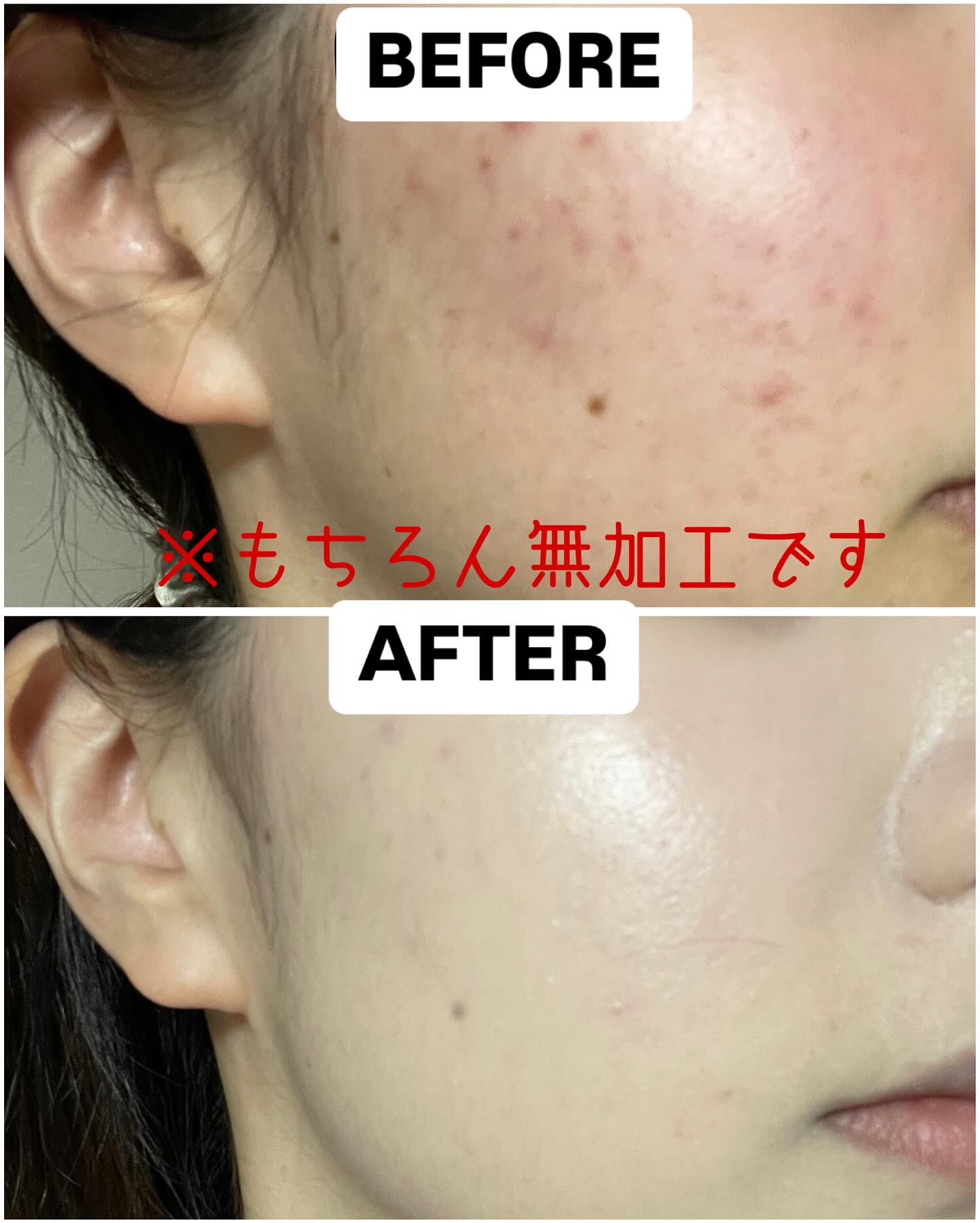 パンテノールバリアクッション/COSNORI/クッションファンデーションを使ったクチコミ（2枚目）