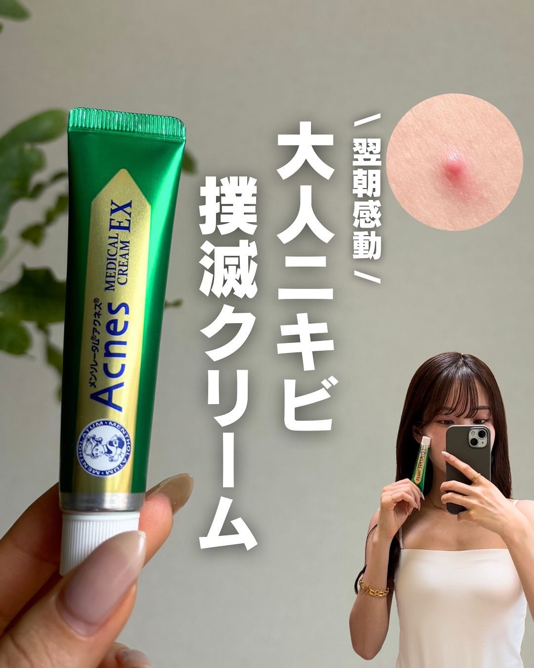 白湯(サユ) | ニキビと戦うOL🤍 on LIPS 「花粉&季節の変わり目でずっと肌ボロボロ…🫠こういう時って赤ニキ..」(1枚目)