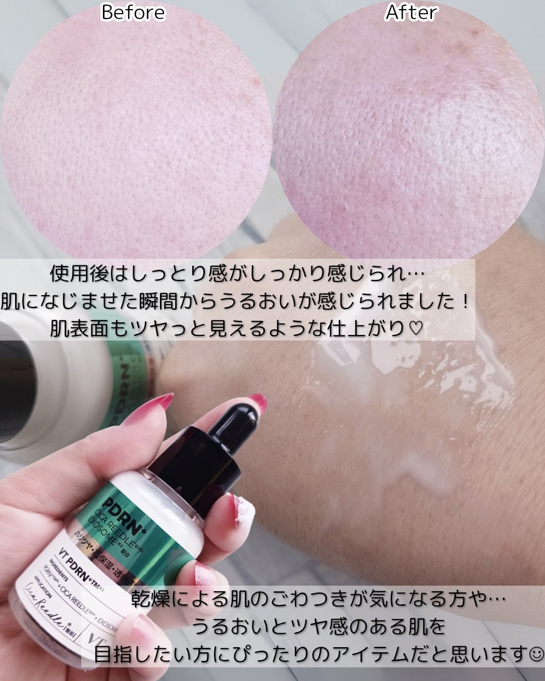 リードルS PDRN+ セラム/VT/美容液を使ったクチコミ(4枚目)