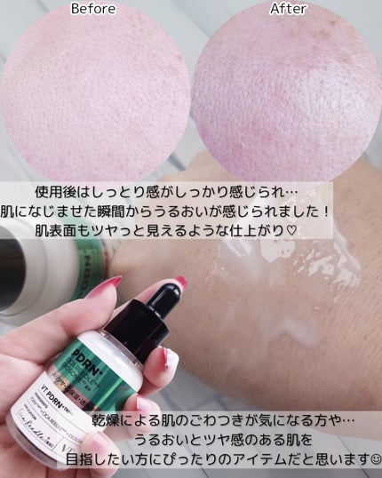 リードルS PDRN+ セラム/VT/美容液を使ったクチコミ(4枚目)