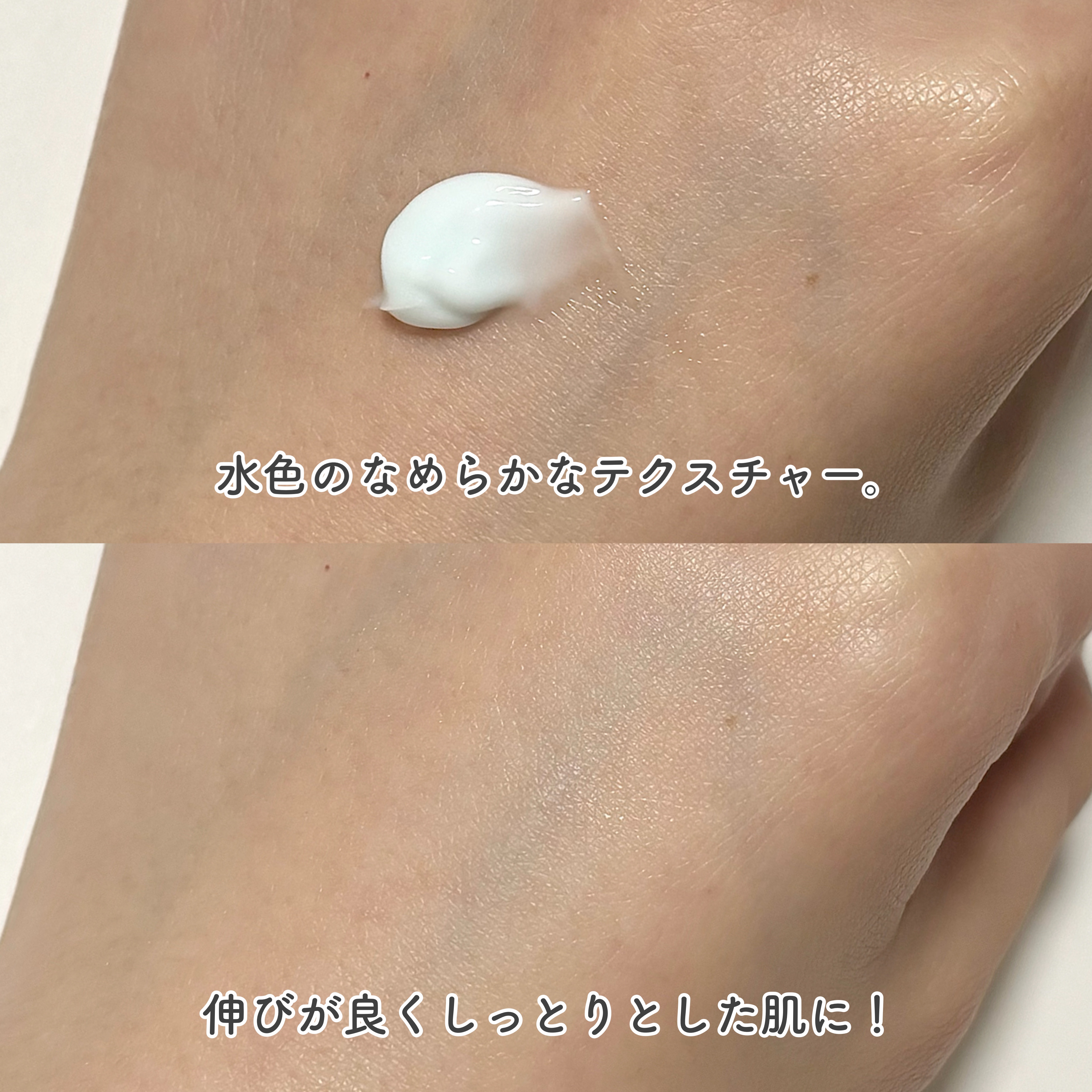 ティーツリーキシリトールウォータージェットクリーム/Vertty/フェイスクリームを使ったクチコミ（3枚目）