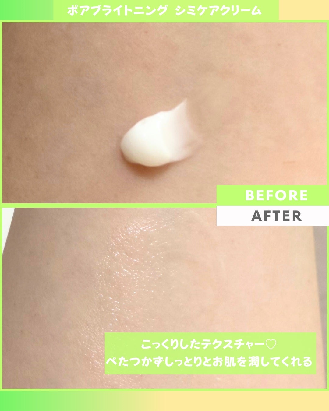 Abo on LIPS 「やっほーAboです🤍✨🌟celimax🌟🩷ポアブライトニングシ..」(6枚目)