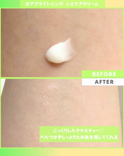 Abo on LIPS 「やっほーAboです🤍✨🌟celimax🌟🩷ポアブライトニングシ..」(6枚目)