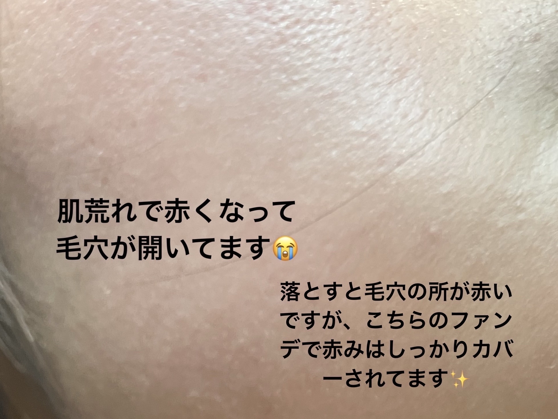 ラディアント タッチ グロウパクト BR10/YVES SAINT LAURENT BEAUTE/クッションファンデーションを使ったクチコミ（3枚目）