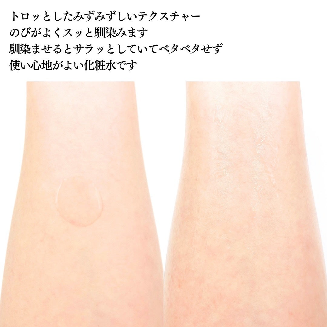 イロハ トリートメントローション/iroha INTIMATE CARE/デリケートゾーンケアを使ったクチコミ(4枚目)