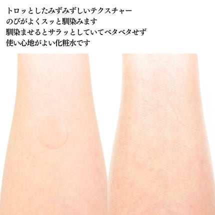 イロハ トリートメントローション/iroha INTIMATE CARE/デリケートゾーンケアを使ったクチコミ(4枚目)