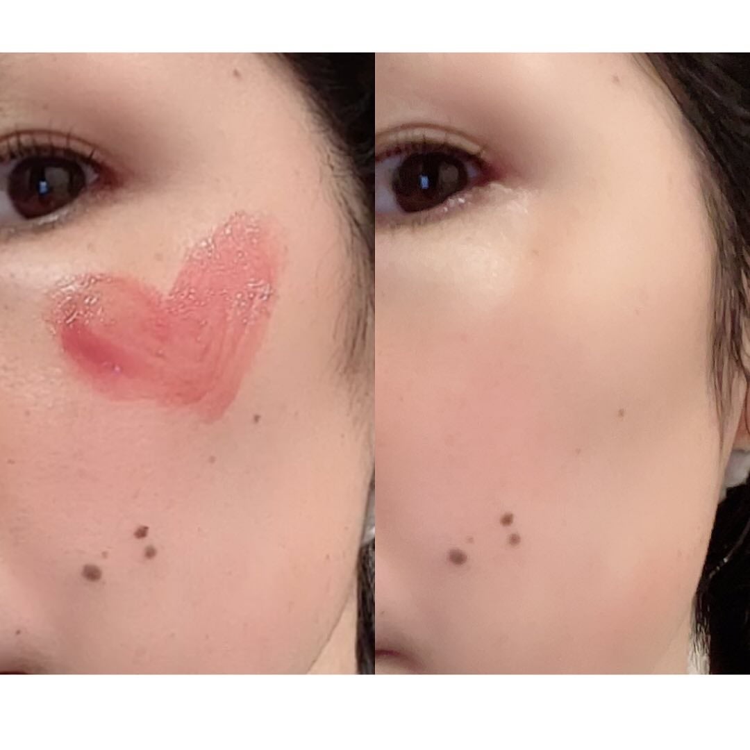 ILSO デュアルクリーンブラシ/ilso/その他スキンケアグッズを使ったクチコミ(6枚目)