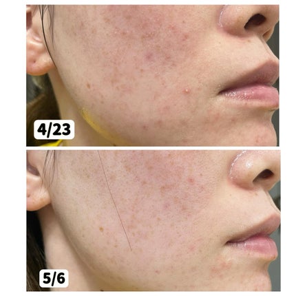 インテカ スージングクリーム/make prem/フェイスクリームを使ったクチコミ(5枚目)