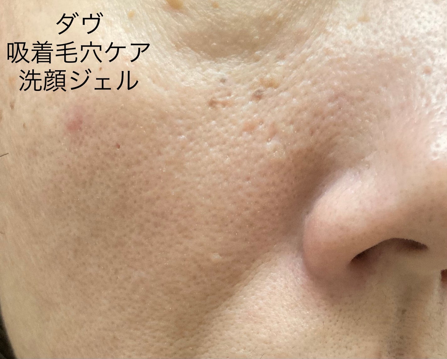 ダヴ 吸着毛穴ケア 洗顔ジェル/ダヴ/その他洗顔料を使ったクチコミ(5枚目)