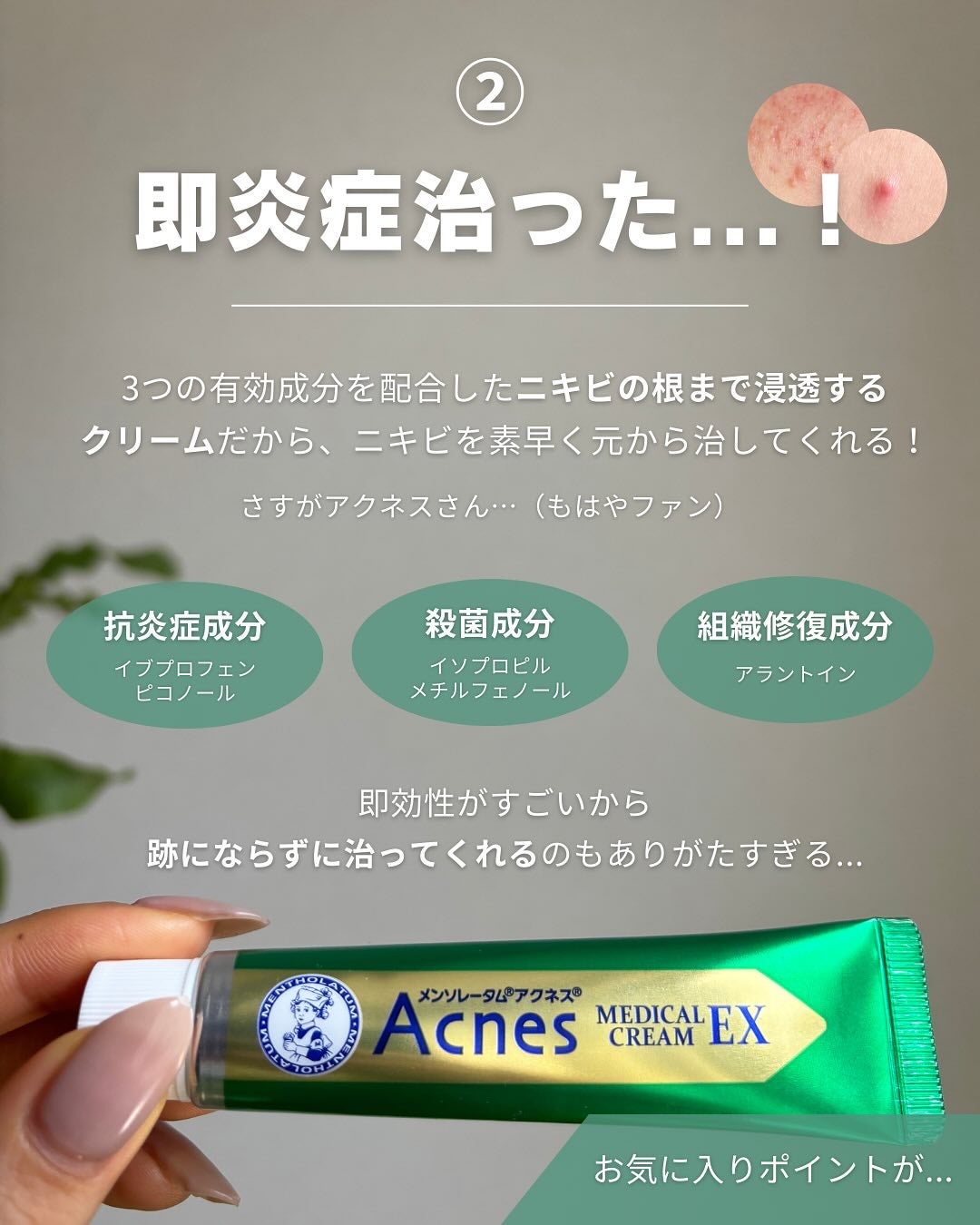 白湯(サユ) | ニキビと戦うOL🤍 on LIPS 「花粉&季節の変わり目でずっと肌ボロボロ…🫠こういう時って赤ニキ..」(5枚目)
