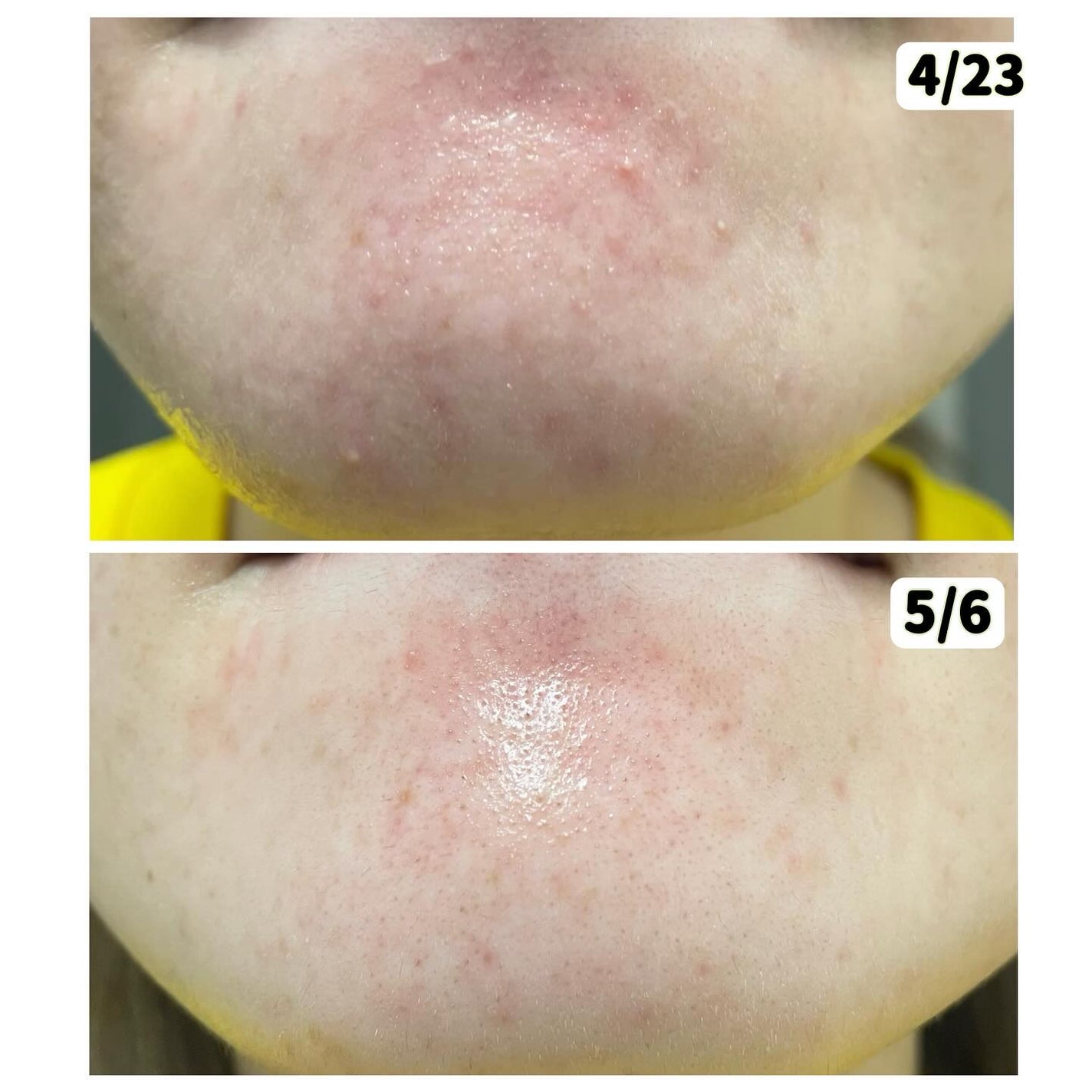 インテカ スージングクリーム/make prem/フェイスクリームを使ったクチコミ(6枚目)