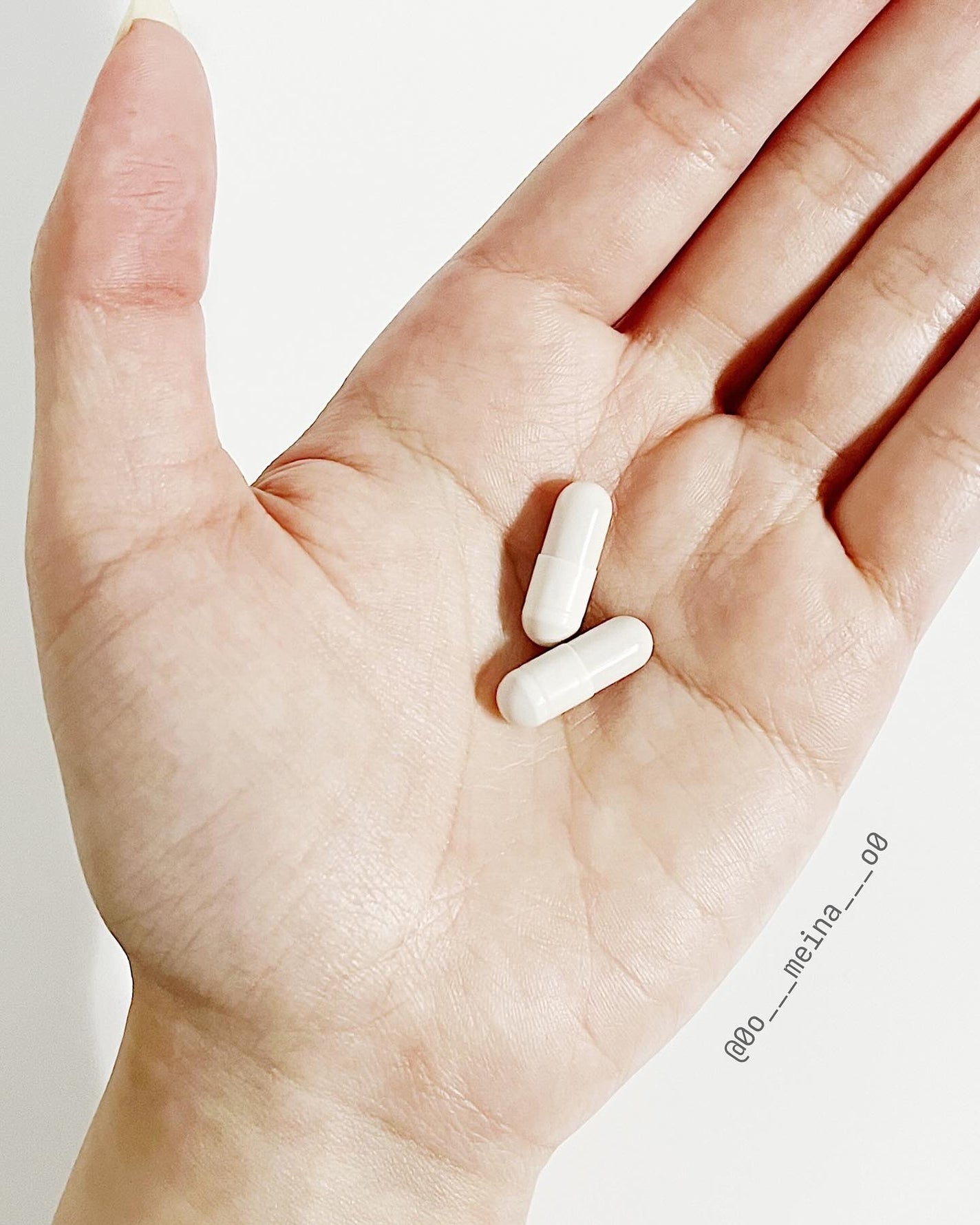 SBC MEDISPA 白玉タチオン/SBC MEDISPA/美容サプリメントを使ったクチコミ(3枚目)