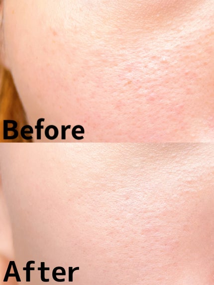 セラミックスキンパーフェクタークッション/AMUSE/ファンデーションを使ったクチコミ(6枚目)