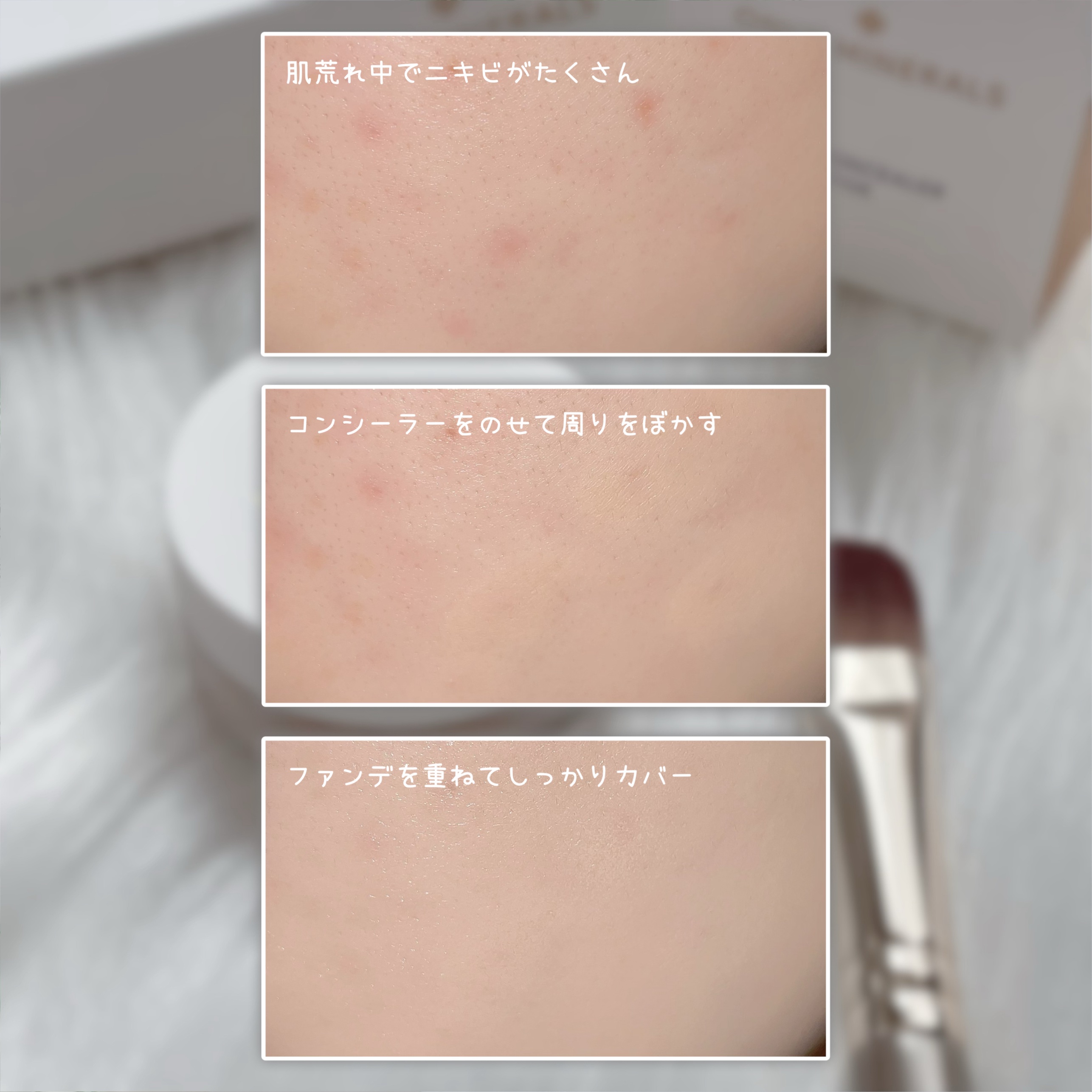 薬用コンシーラー アクネプロテクター/ONLY MINERALS/パウダーコンシーラーを使ったクチコミ（3枚目）