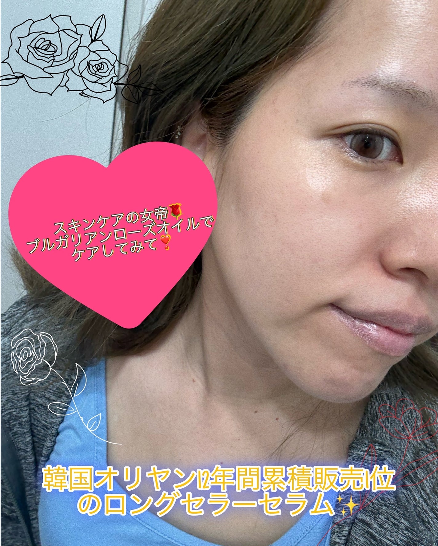 ブレミッシュケアアップ セラム/ISOI/美容液を使ったクチコミ(4枚目)