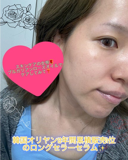 ブレミッシュケアアップ セラム/ISOI/美容液を使ったクチコミ(4枚目)