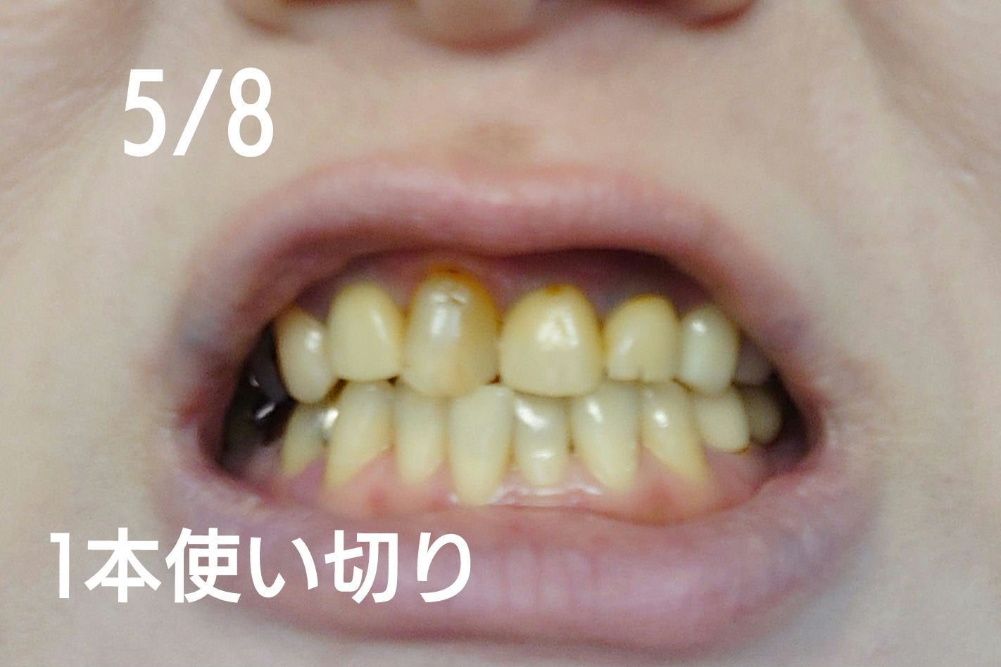 シュミテクト フューチャーホワイトケア(医薬部外品)6歳以上用/シュミテクト/歯磨き粉を使ったクチコミ(3枚目)