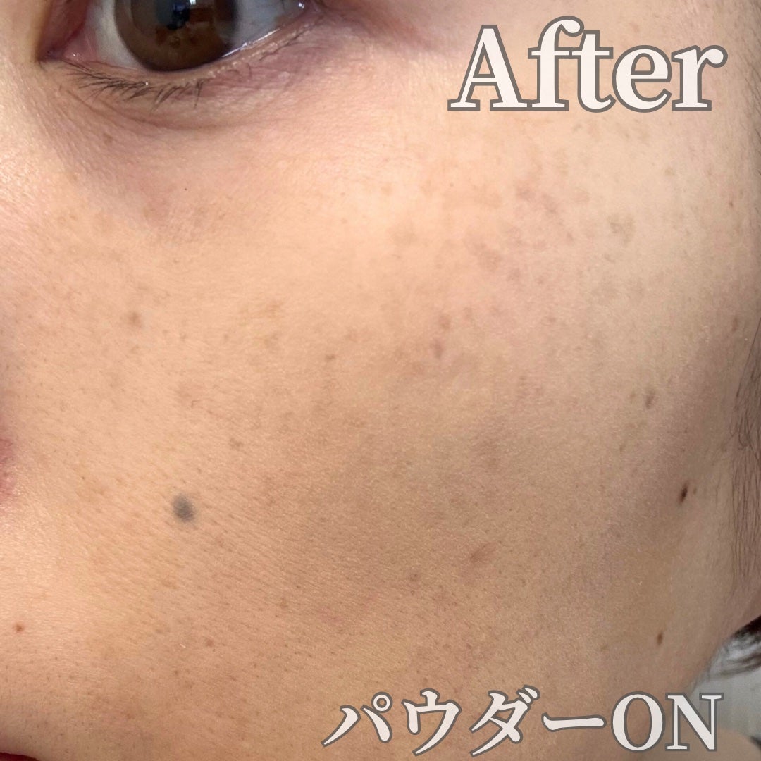 ハイドラセッティングパウダー/byLieto/プレストパウダーを使ったクチコミ(5枚目)