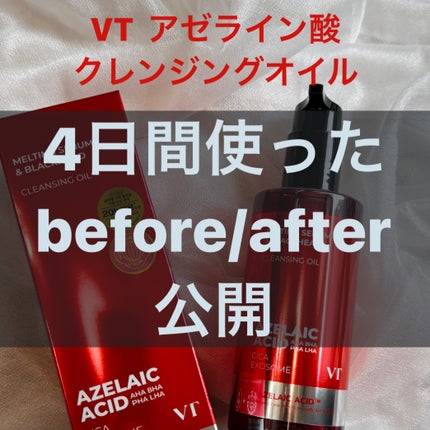 AZケア クレンジングオイル/VT/オイルクレンジングを使ったクチコミ(1枚目)