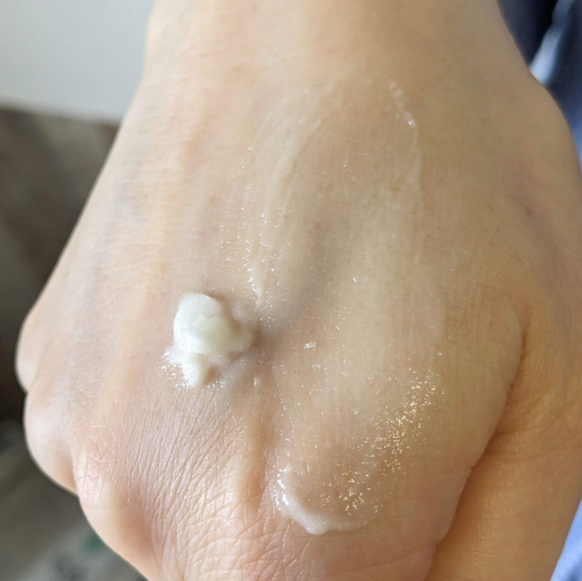 NOX LAB ビタマックス アイシング スージングジェル/ISAKNOX(イザノックス)/フェイスクリームを使ったクチコミ（3枚目）