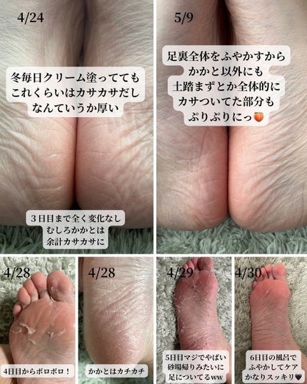 かかと どうスルん??そうスルんDX/Stay Free/レッグ・フットケアを使ったクチコミ(5枚目)