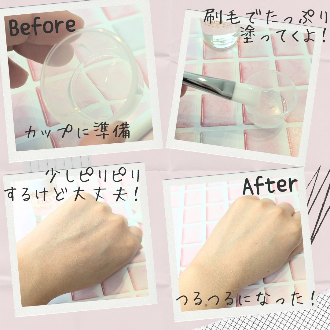 ＭＤピーリングキット II/セラ/ピーリングを使ったクチコミ（3枚目）