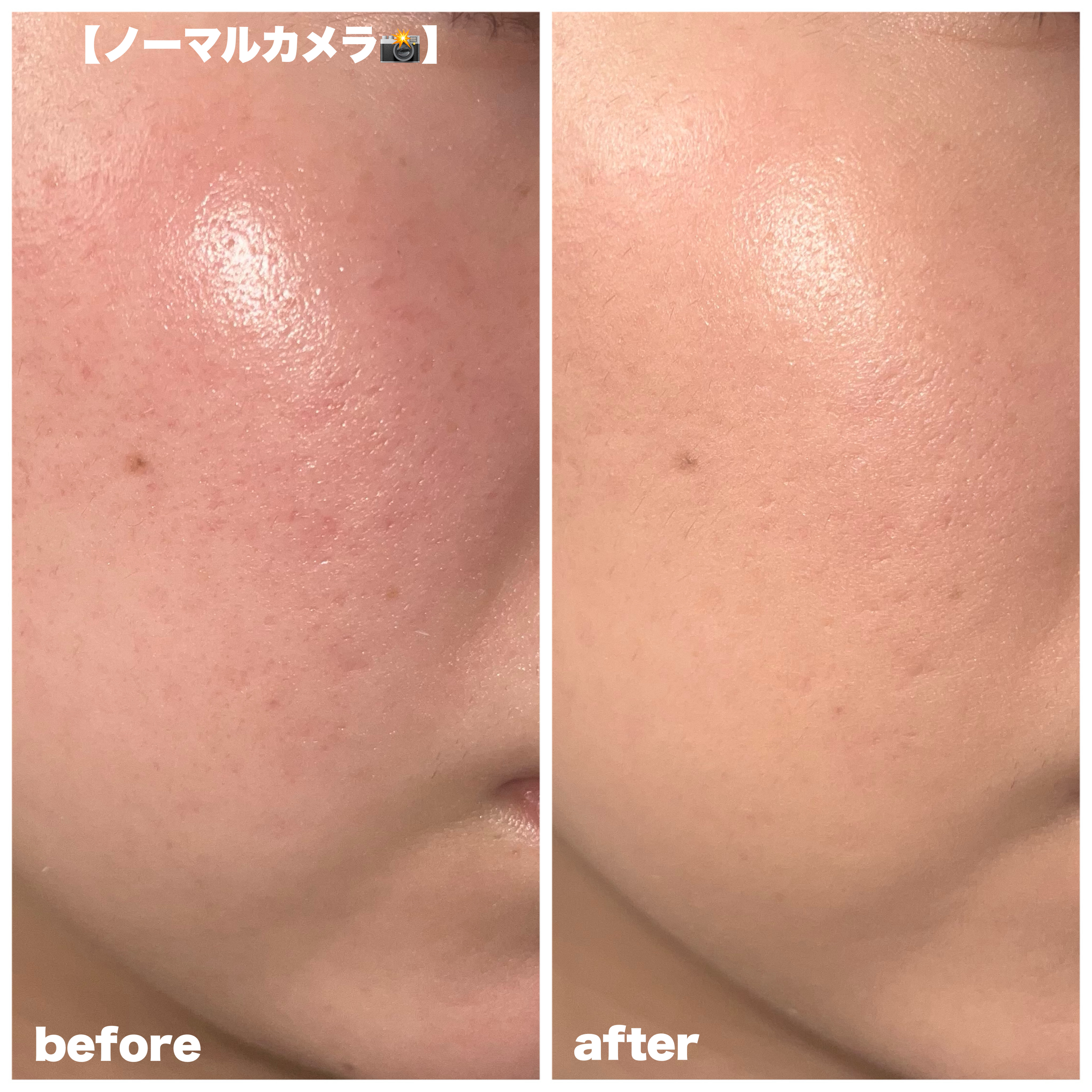 SPステイ ルミマット リキッド ファンデーション/MAYBELLINE NEW YORK/リキッドファンデーションを使ったクチコミ（3枚目）