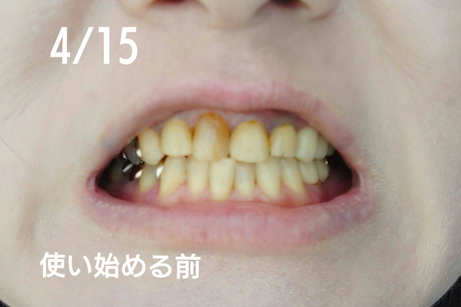 シュミテクト フューチャーホワイトケア（医薬部外品）6歳以上用/シュミテクト/歯磨き粉を使ったクチコミ（2枚目）