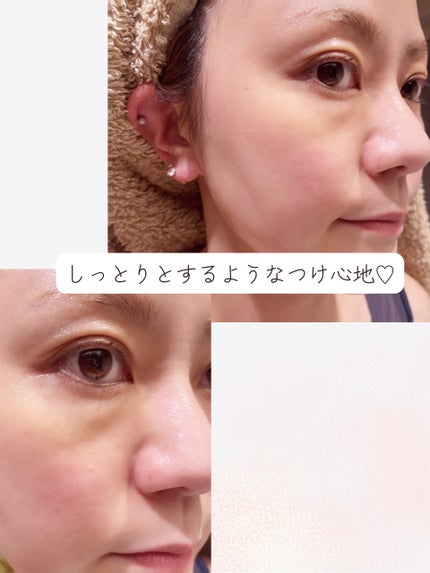 ドクダミ77 % 鎮静マスクパック/Anua/シートマスク・パックを使ったクチコミ(5枚目)