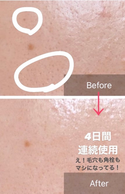 AZケア クレンジングオイル/VT/オイルクレンジングを使ったクチコミ(4枚目)