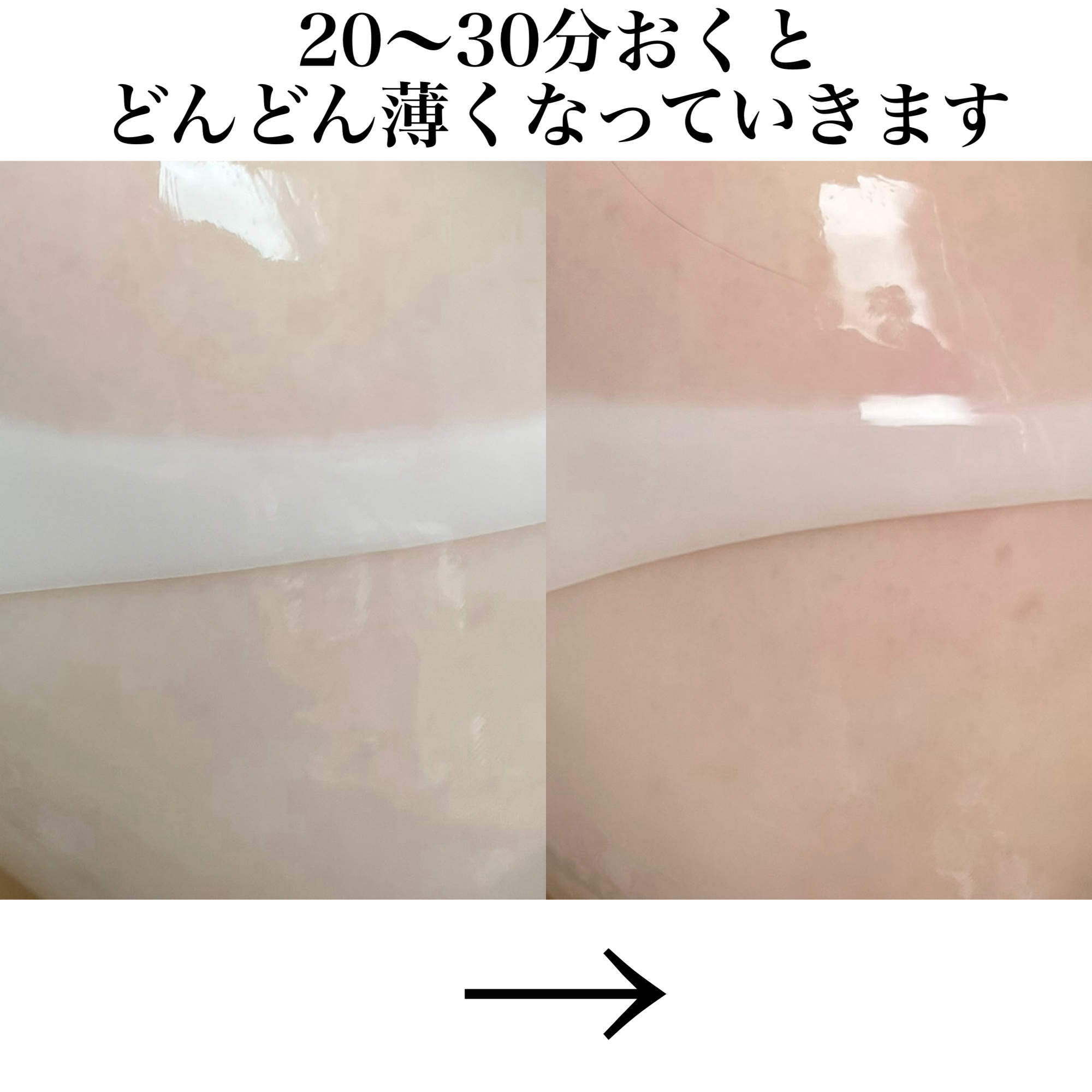 PDRN ハイドロゲルマスクパック/COSNORI/シートマスク・パックを使ったクチコミ（3枚目）